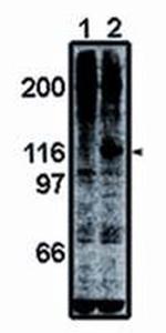 FAK Antibody in Western Blot (WB)