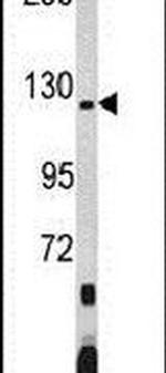 PUM1 Antibody in Western Blot (WB)