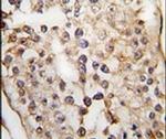 PUM2 Antibody in Immunohistochemistry (IHC)