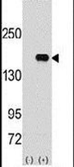 PUM2 Antibody in Western Blot (WB)