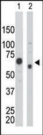 PKM2 Antibody in Western Blot (WB)