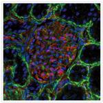 Rabbit IgG (H+L) Secondary Antibody in Immunohistochemistry (IHC)