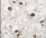 QKI Antibody in Immunohistochemistry (IHC)