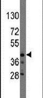 QKI Antibody in Western Blot (WB)