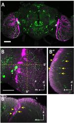 TagRFP Antibody in Immunohistochemistry (IHC)