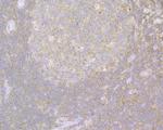 Beta Actin Antibody in Immunohistochemistry (Paraffin) (IHC (P))