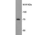PRMT5 Antibody in Western Blot (WB)