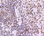 TRIM28 Antibody in Immunohistochemistry (Paraffin) (IHC (P))
