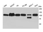 TRIM28 Antibody in Western Blot (WB)