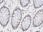 PCNA Antibody in Immunohistochemistry (Paraffin) (IHC (P))