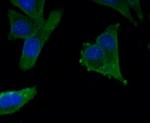 AXL Antibody in Immunocytochemistry (ICC/IF)