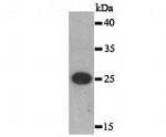 AXL Antibody in Western Blot (WB)