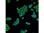 ALDH2 Antibody in Immunocytochemistry (ICC/IF)