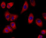 ERp72 Antibody in Immunocytochemistry (ICC/IF)