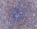 IL-6 Antibody in Immunohistochemistry (Paraffin) (IHC (P))