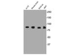 PSD95 Antibody in Western Blot (WB)