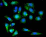 BMPR1A Antibody in Immunocytochemistry (ICC/IF)