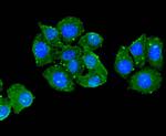 BMPR1A Antibody in Immunocytochemistry (ICC/IF)