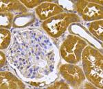 BMPR1A Antibody in Immunohistochemistry (Paraffin) (IHC (P))