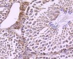 mTOR Antibody in Immunohistochemistry (Paraffin) (IHC (P))