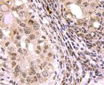 SMAD3 Antibody in Immunohistochemistry (Paraffin) (IHC (P))