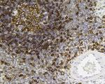 HLA-DR Antibody in Immunohistochemistry (Paraffin) (IHC (P))