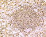 HLA-DR Antibody in Immunohistochemistry (Paraffin) (IHC (P))