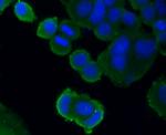 PDGF Receptor beta Antibody in Immunocytochemistry (ICC/IF)