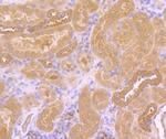 EGFR Antibody in Immunohistochemistry (Paraffin) (IHC (P))