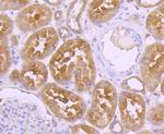 EGFR Antibody in Immunohistochemistry (Paraffin) (IHC (P))