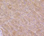 EGFR Antibody in Immunohistochemistry (Paraffin) (IHC (P))