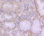 EGFR Antibody in Immunohistochemistry (Paraffin) (IHC (P))