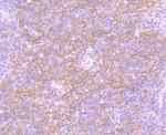 EGFR Antibody in Immunohistochemistry (Paraffin) (IHC (P))