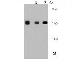 EGFR Antibody in Western Blot (WB)