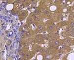 Smad2 Antibody in Immunohistochemistry (Paraffin) (IHC (P))