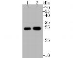 PGP9.5 Antibody in Western Blot (WB)