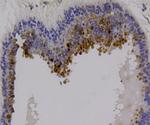 RON Antibody in Immunohistochemistry (Paraffin) (IHC (P))