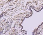 AFP Antibody in Immunohistochemistry (Paraffin) (IHC (P))