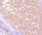 AFP Antibody in Immunohistochemistry (Paraffin) (IHC (P))