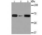 AFP Antibody in Western Blot (WB)