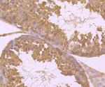 Hsc70 Antibody in Immunohistochemistry (Paraffin) (IHC (P))