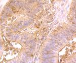 Hsc70 Antibody in Immunohistochemistry (Paraffin) (IHC (P))
