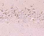 Tyrosine Hydroxylase Antibody in Immunohistochemistry (Paraffin) (IHC (P))