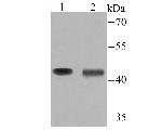 Tyrosine Hydroxylase Antibody in Western Blot (WB)