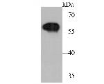 Tyrosine Hydroxylase Antibody in Western Blot (WB)