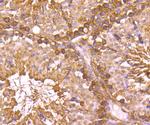 G6PD Antibody in Immunohistochemistry (Paraffin) (IHC (P))