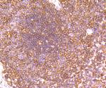G6PD Antibody in Immunohistochemistry (Paraffin) (IHC (P))