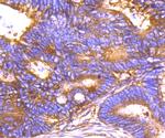 G6PD Antibody in Immunohistochemistry (Paraffin) (IHC (P))