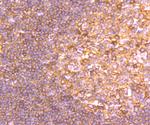 G6PD Antibody in Immunohistochemistry (Paraffin) (IHC (P))