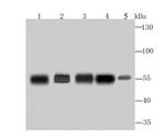 G6PD Antibody in Western Blot (WB)